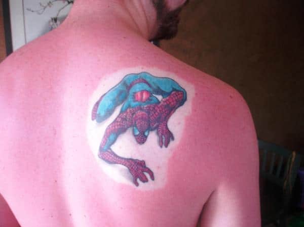 sunburn on tattoo