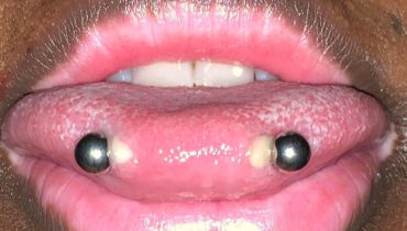 45 Snake Eye Piercing Ideas with Pain Info & Aftercare Guide